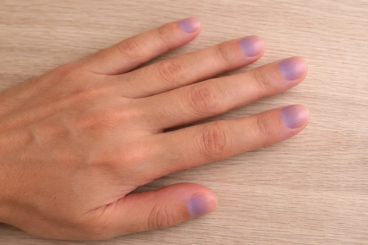 Do purple nails have any cultural meanings or health associations