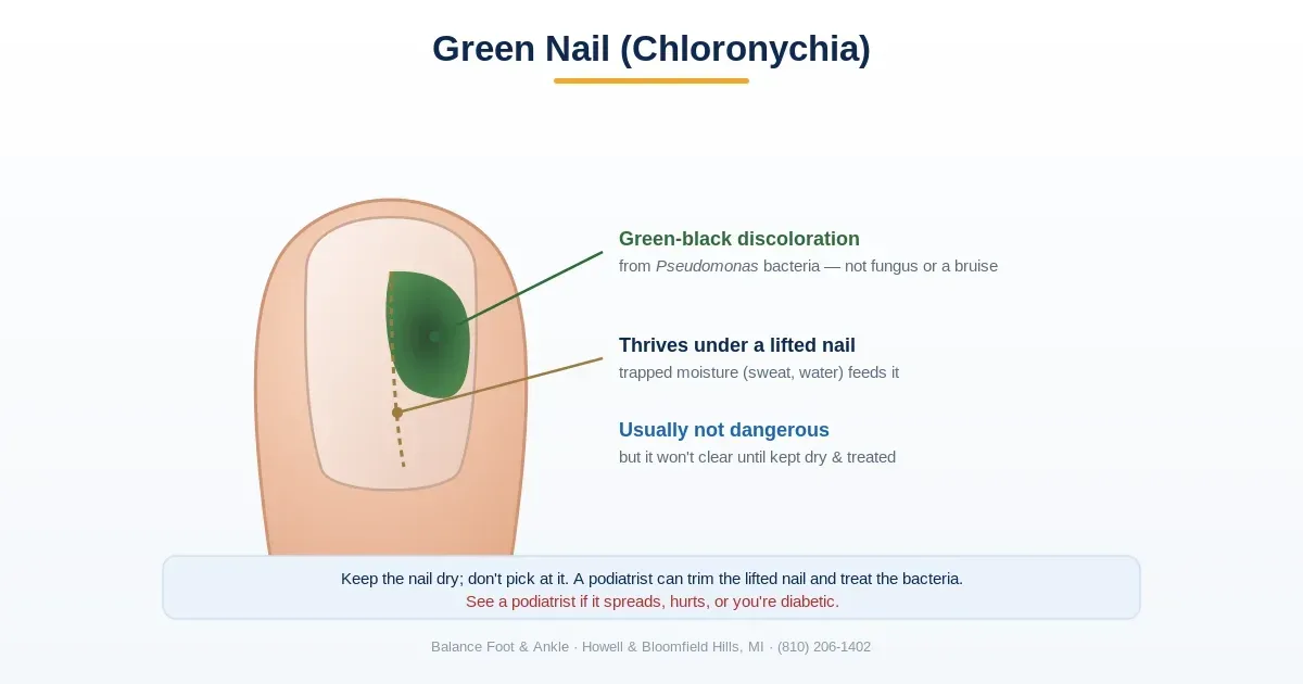 How Can I Prevent Green Nail Discoloration